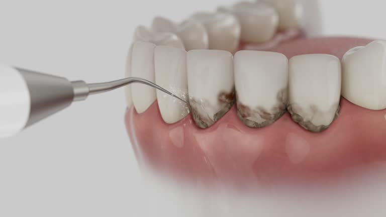 Trusted Dental Crowns And Bridges service in North Terre Haute, IN - Dentist Open Now